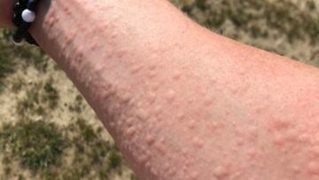 C142A27E-4B95-49C6-B980-D6D73FCA7765